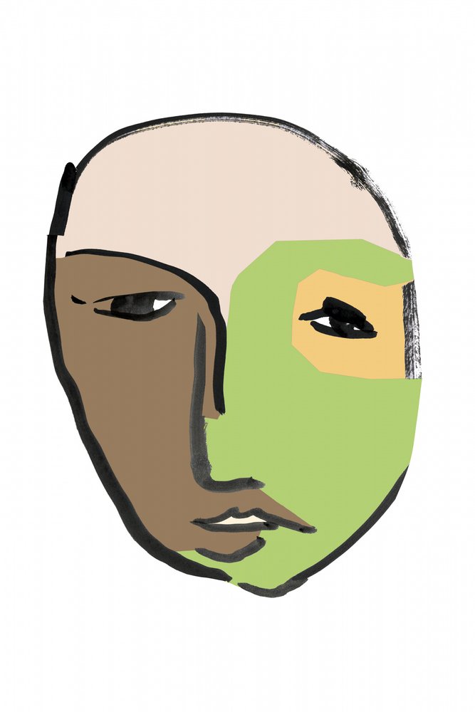  od cartissi