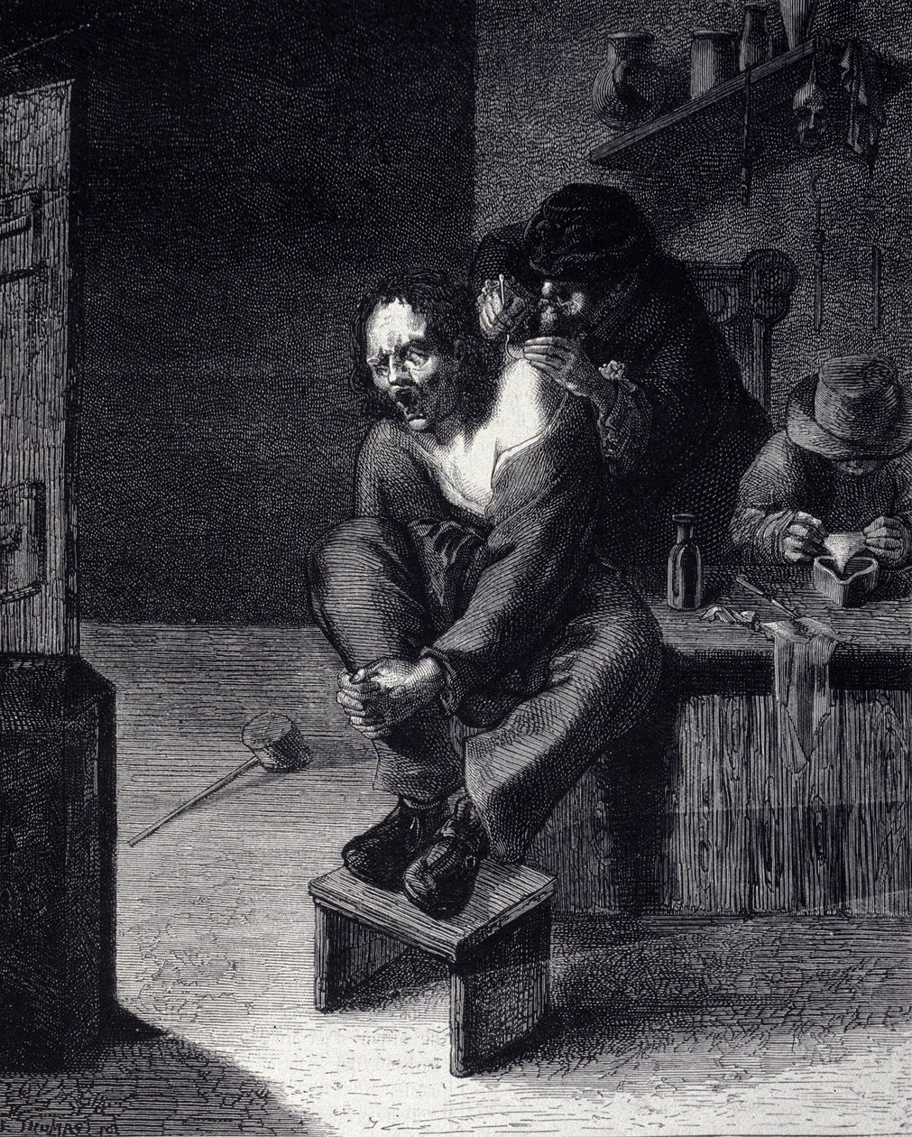 Chirurgická operace Rytina podle obrazu Adriena Brauwera (dělal 1608) 17. stol. od Adriaen (after) Brouwer
