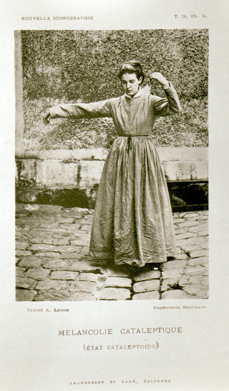 Kataleptická melancholie, z „Nouvelle Iconographie de la Salpetriere“ od profesora Jeana Martina Charcota (1825-93), vydané v Paříži, 1889 od Albert Londe