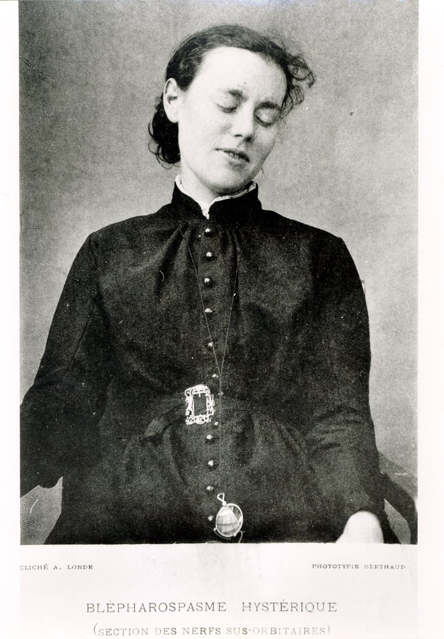 Nedobrovolný blefarospazmus, z „Nouvelle Iconographie de la Salpetriere“ od profesora Jeana Martina Charcota (1825-93), vydaného v Paříži, 1889 od Albert Londe
