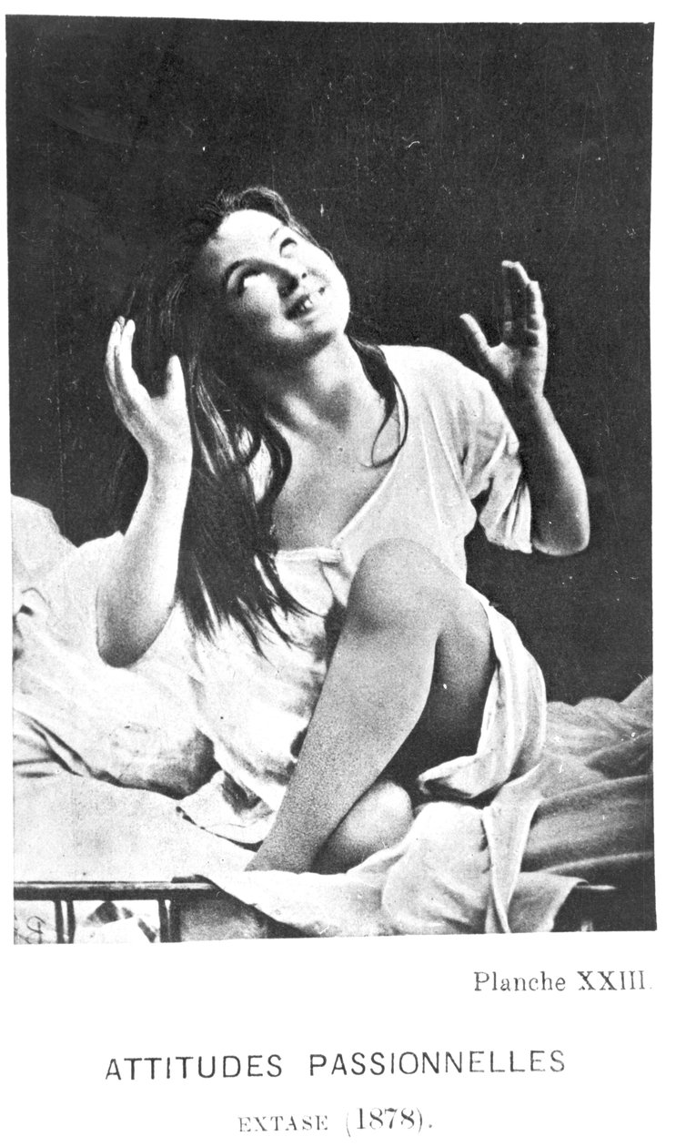 Vášnivé postoje: Augustin v extázi, z „Iconographie de la Salpetriere“ od Desire Magloire Bourneville (1840-1909) a Paula Regnarda (1850-1927) 1878 od Albert Londe
