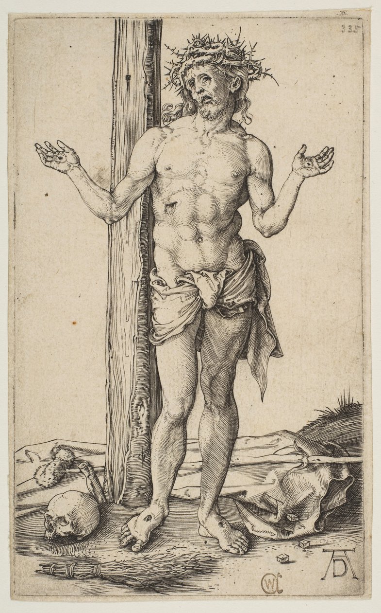 Muž bolesti s nataženýma rukama, ca. 1500. od Albrecht Dürer