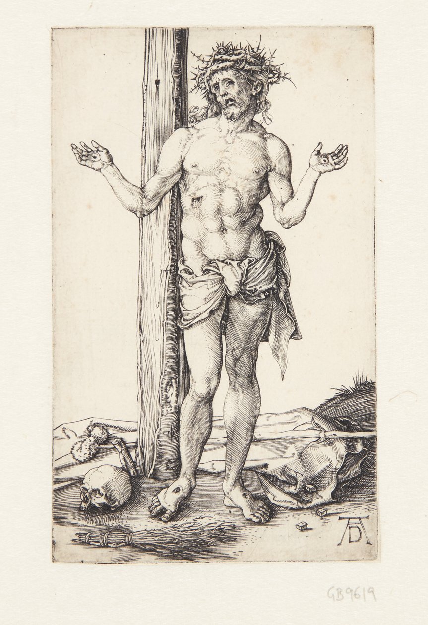 Muž bolesti se zdviženýma rukama od Albrecht Dürer