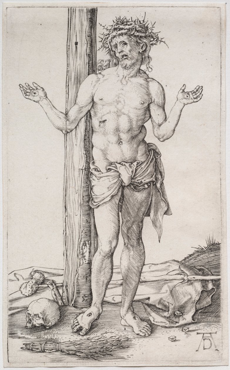 Muž bolesti stojící, se zdviženýma rukama, c. 1500. od Albrecht Dürer