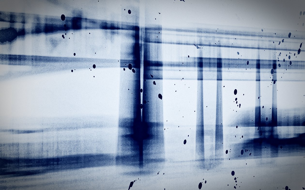 Sníh (rentgen), 2019, (fotografie) od Alex Caminker