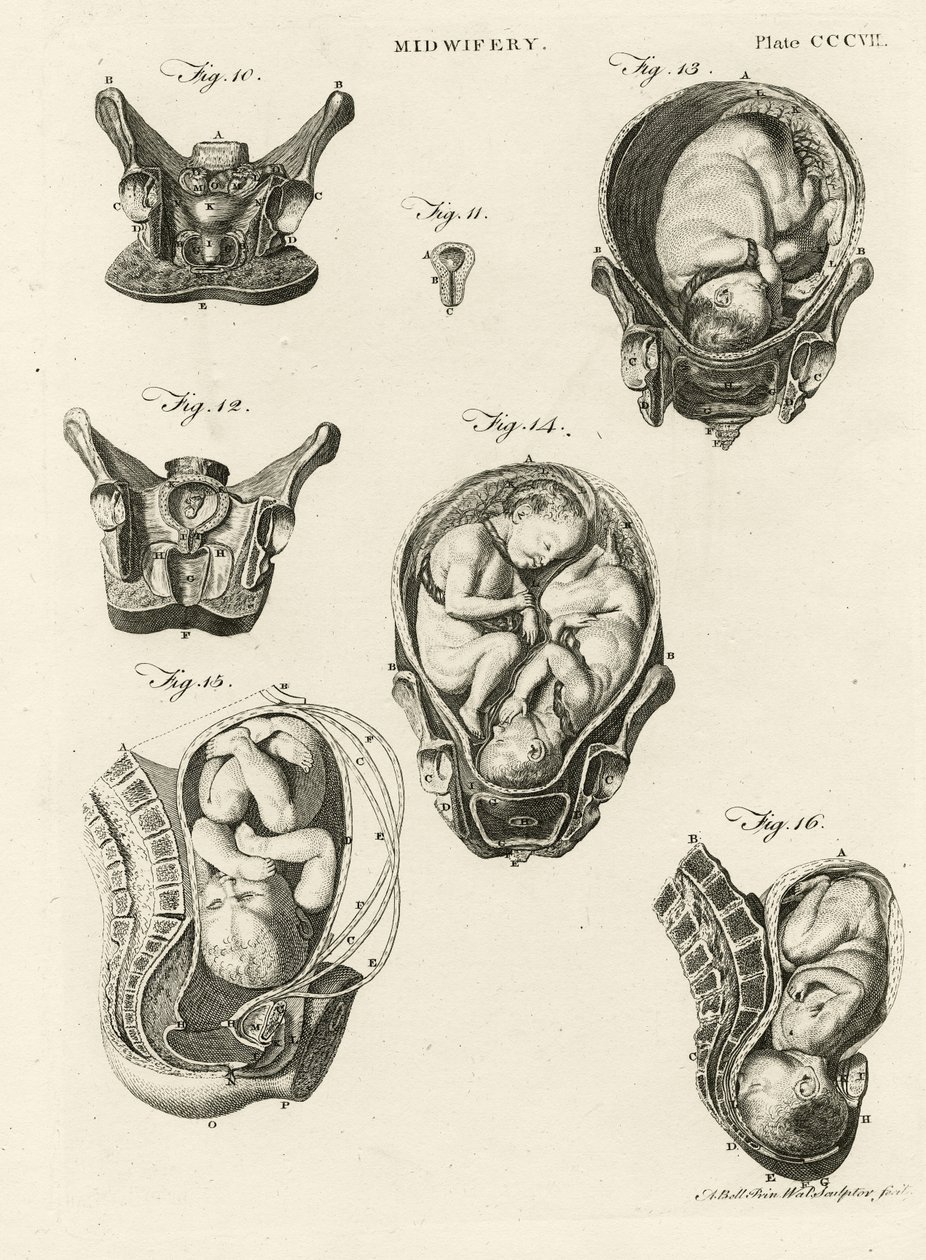 Porodnictví, ilustrace z 