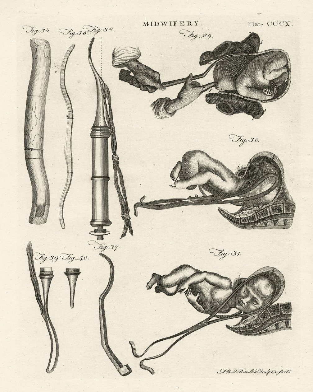 Porodnictví, ilustrace z 