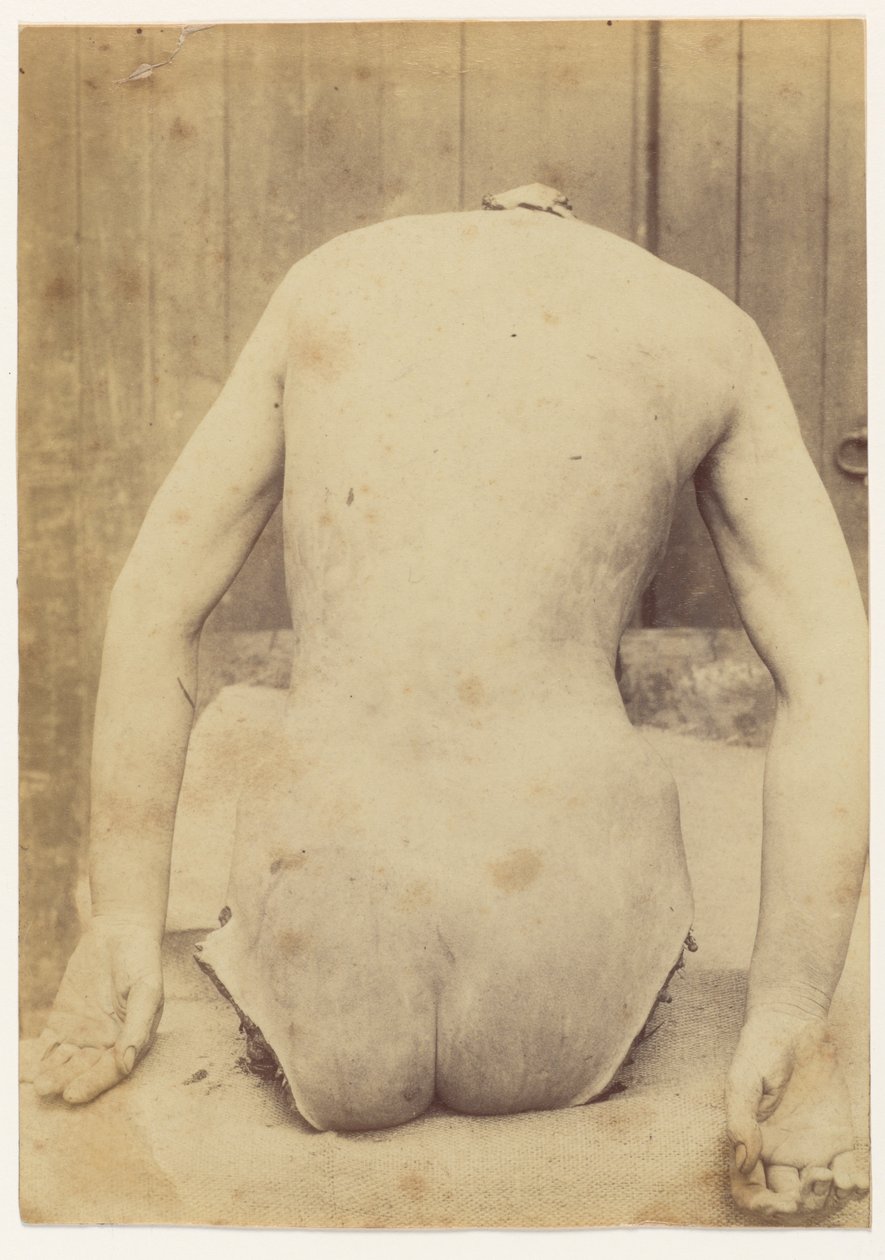 Pohled na zadní část kufru od Alphonse Bertillon