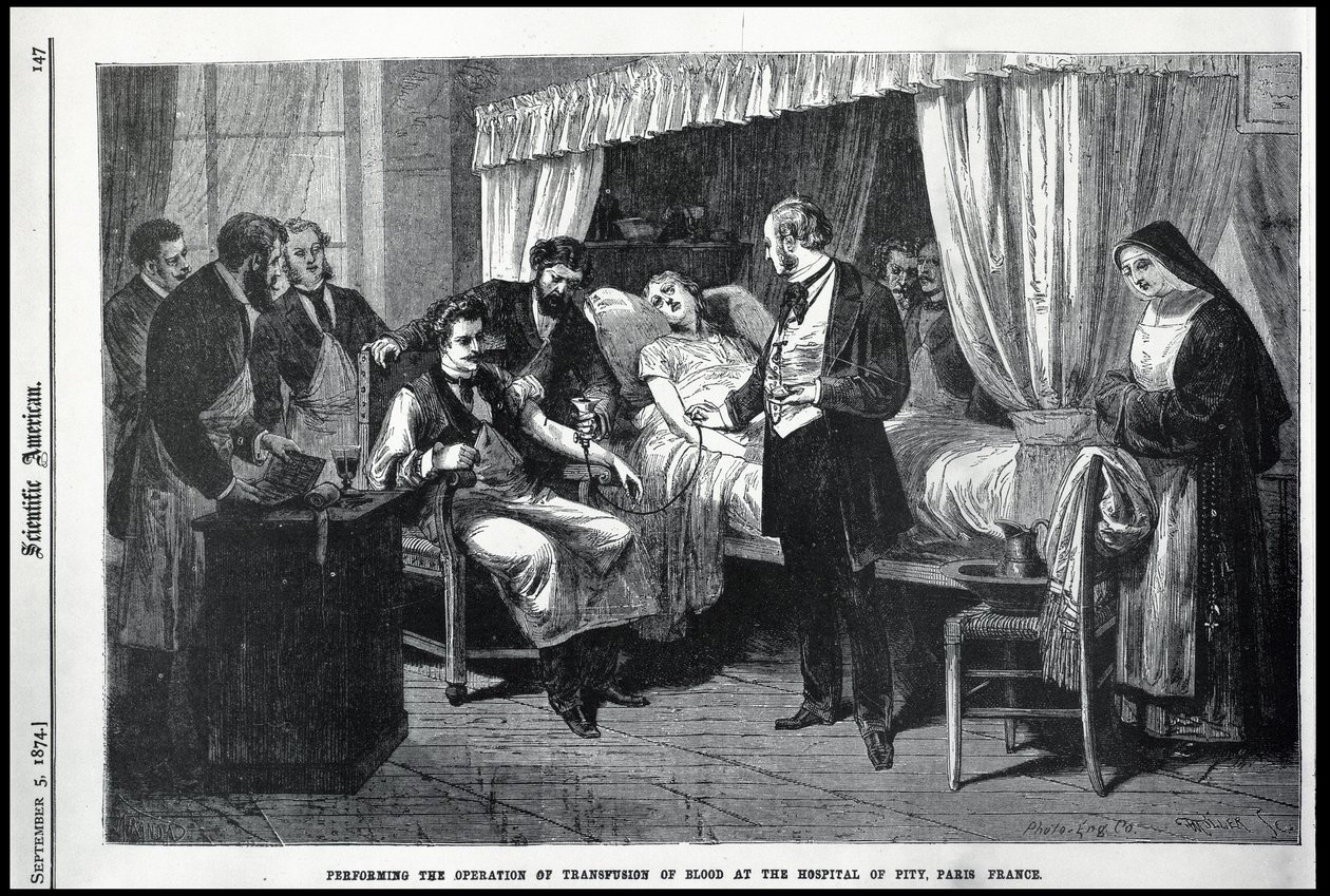 Provádění operace transfuze krve v nemocnici Pity, Paříž, Francie, ilustrace od American Scientist od American School
