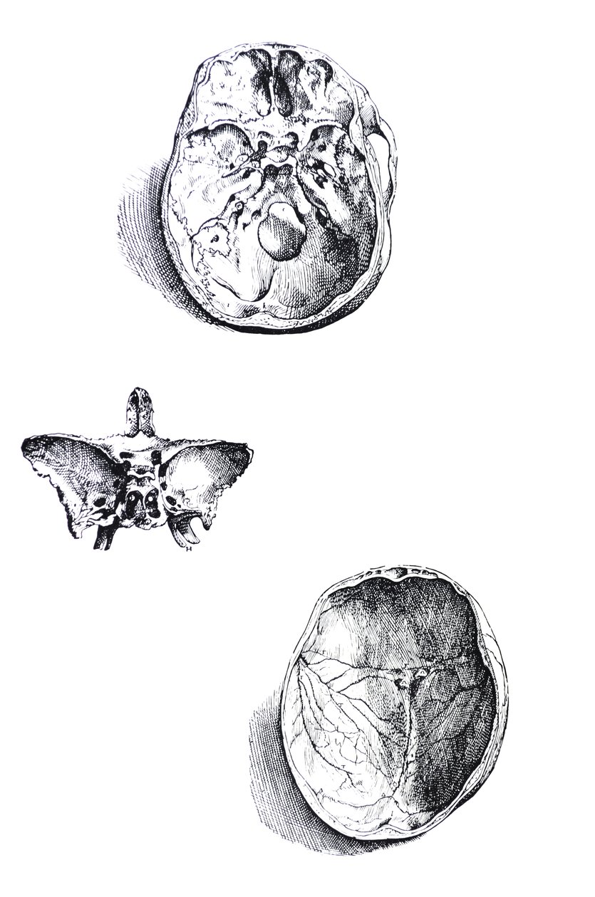 Desky z první knihy De Humani Corporis Fabrica od Andreas Vesalius