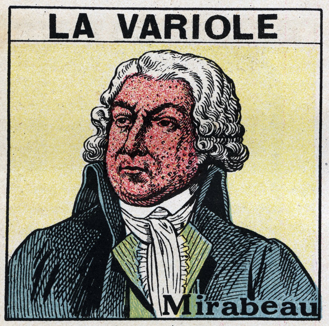Portrét Honore Gabriela (Honore-Gabriel) Riquetiho, hraběte z Mirabeau (1749-1791) s tváří postavy po neštovicích. Aby se zabránilo jizvám způsobeným neštovicemi, pacienti by měli být léčeni v místnostech nebo by měli vstupovat pouze do červeného světla be od Anonymous Anonymous