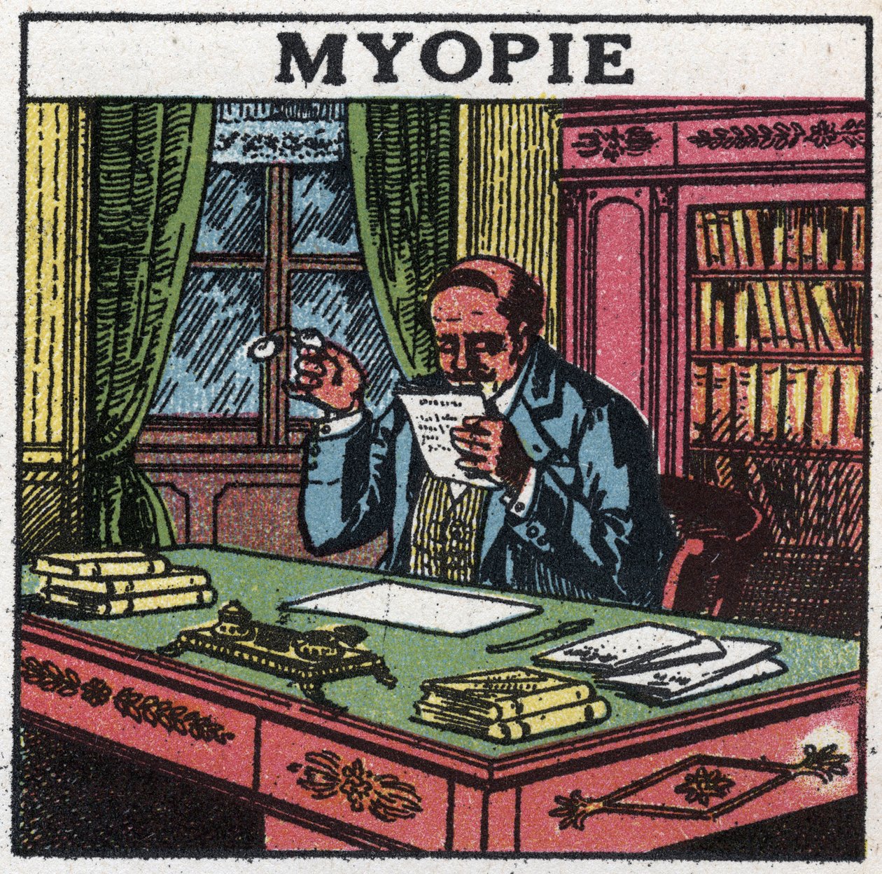 Oko: osoba trpící krátkozrakostí. Anonymní ilustrace z roku 1925. Soukromá sbírka. od Anonymous Anonymous