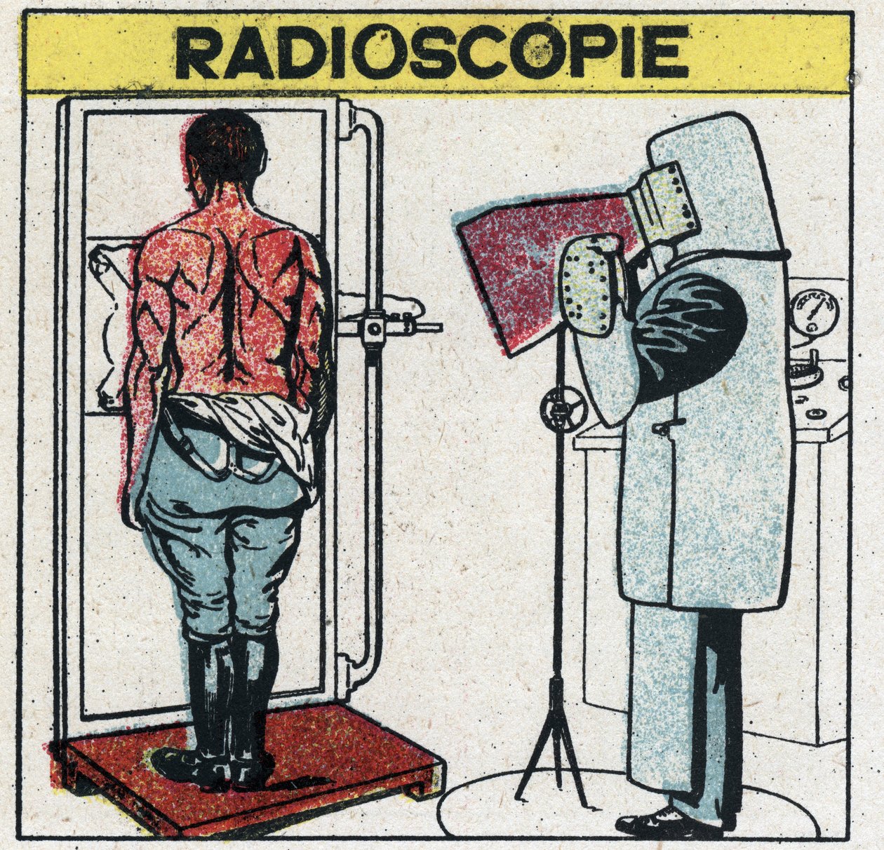 Rentgenové záření: radioskopie lidského těla. Radiolog se před rentgenovým zářením chrání hadříkem z pryžové látky s kaučukovým rozpuštěním obsahujícím soli olova, hlavu má zakrytou čepicí a ruce rukavicemi ze stejné látky, oči má pr od Anonymous Anonymous