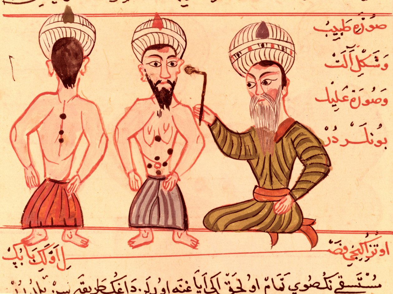 Ms Sup Turc 693 fol.35 Operace pro kauterizaci, 1466 od Charaf ed Din
