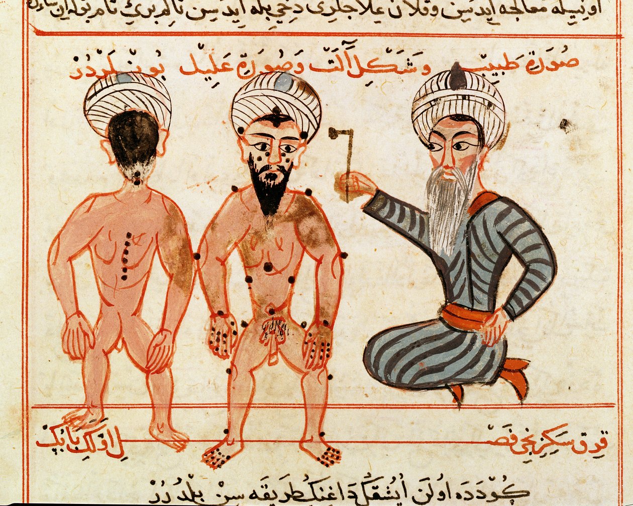 Paní Sup Turc 693 fol. 46v Kauterizace lézí lepry, 1466 od Charaf ed Din