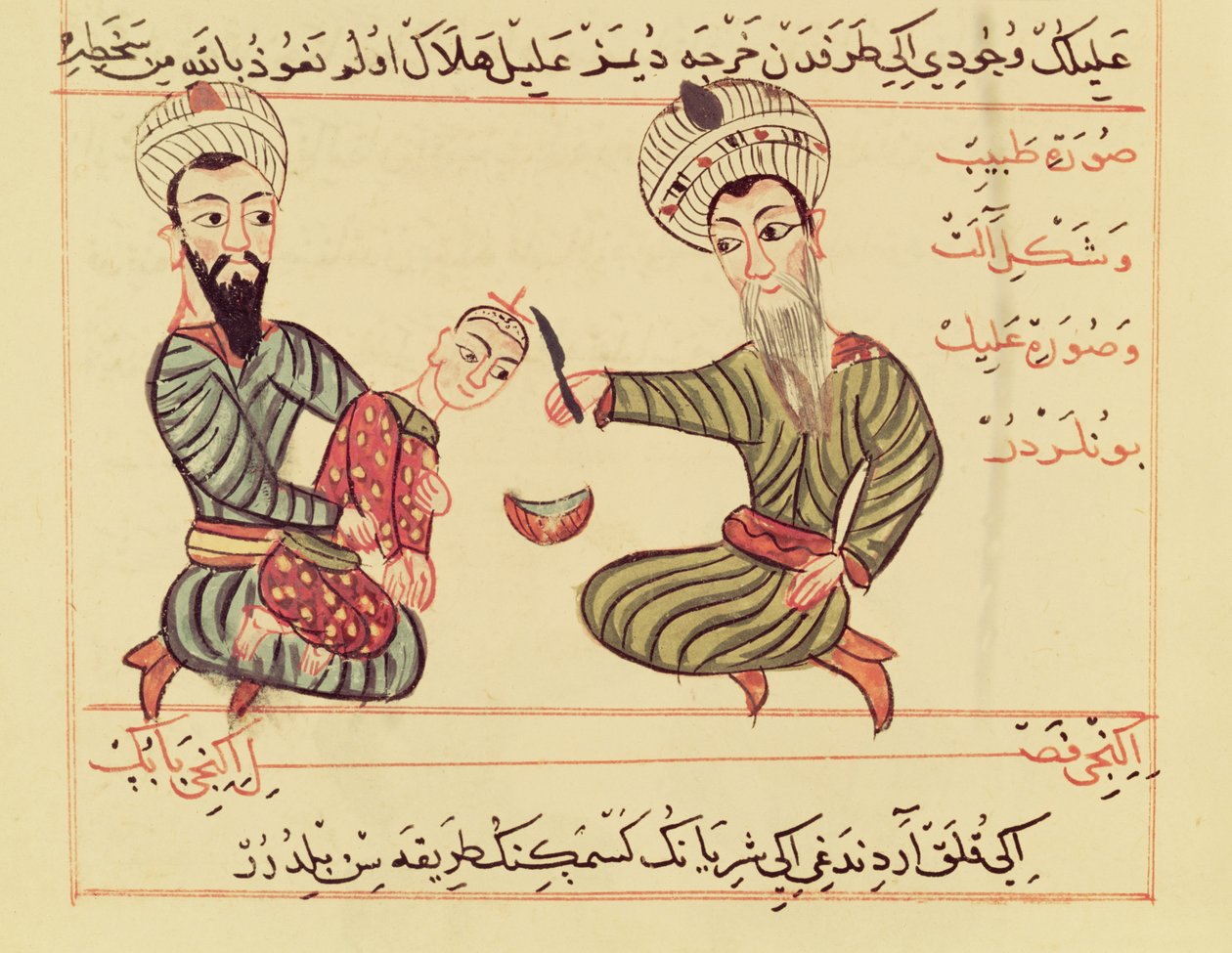 Ms Sup Turc 693 fol.53 Odčerpávání nahromaděné tekutiny z hlavy dítěte,1466 od Charaf ed Din