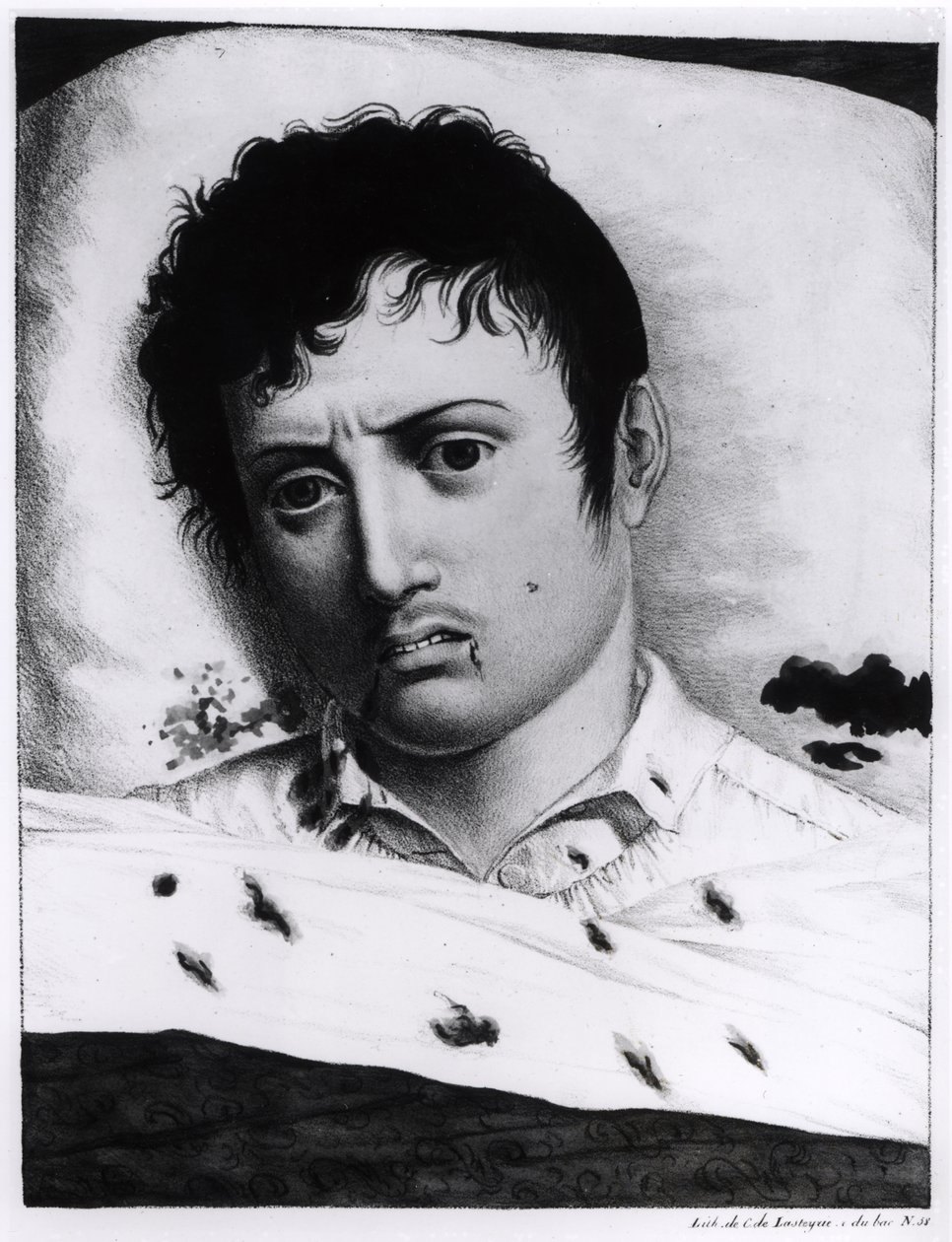 Pozorování žluté zimnice, c.1819 od Charles Lasteyrie du Saillant