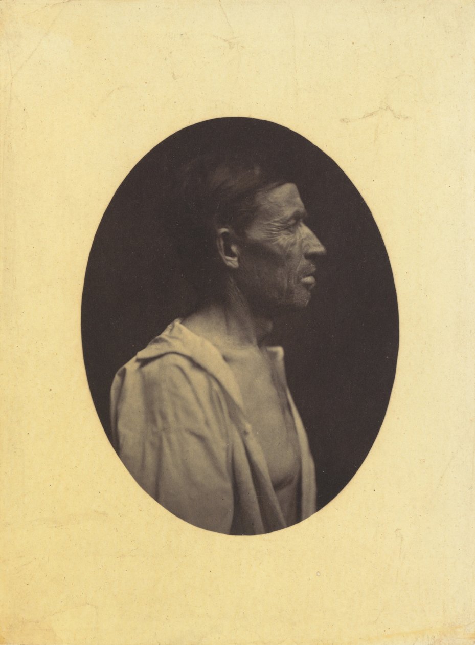 Portrét muže, 42 let, ohromeného nadměrným pitím alkoholu..., 1854-1856, z profilu. od Duchenne de Boulogne