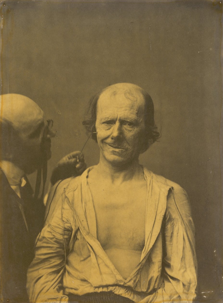 Uvolněná tvář vlevo, falešná radost nebo smích vpravo, 1854-1856, tištěno 1862. od Duchenne de Boulogne