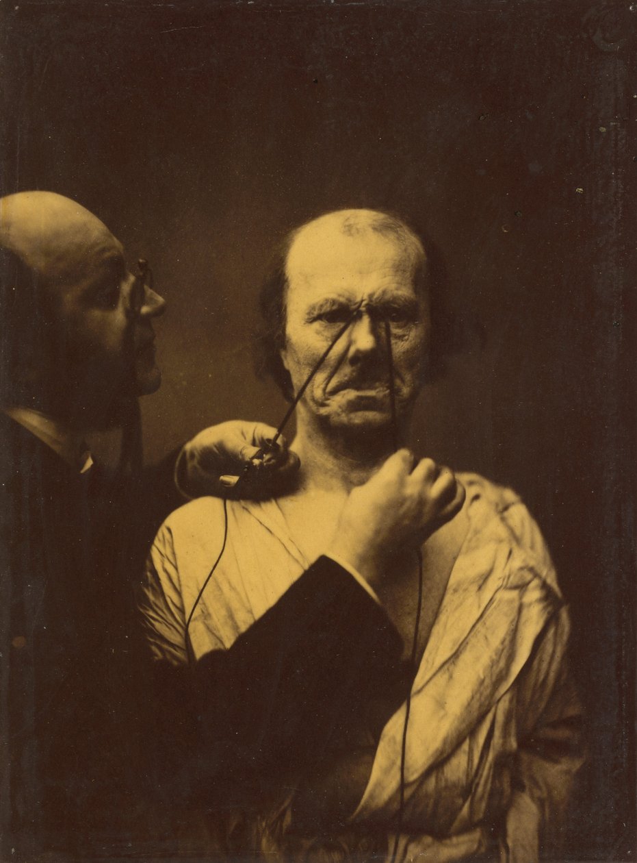 Agrese, zloba, 1854-1856, tištěno 1862. od Duchenne de Boulogne
