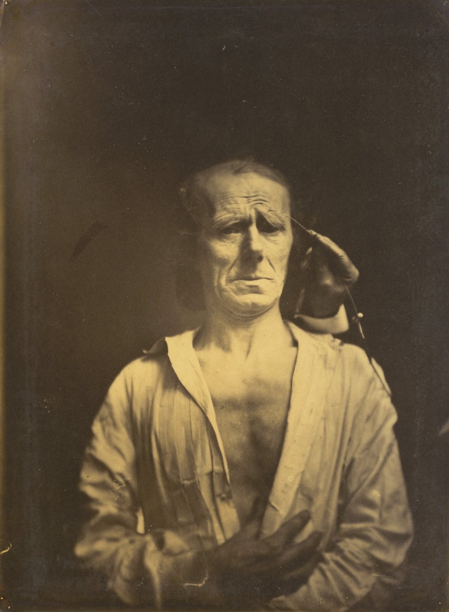 Křeč m. corrugator supercilii pod velmi silným světlem vlevo, Uvolněná tvář..., 1854-1855. od Duchenne de Boulogne