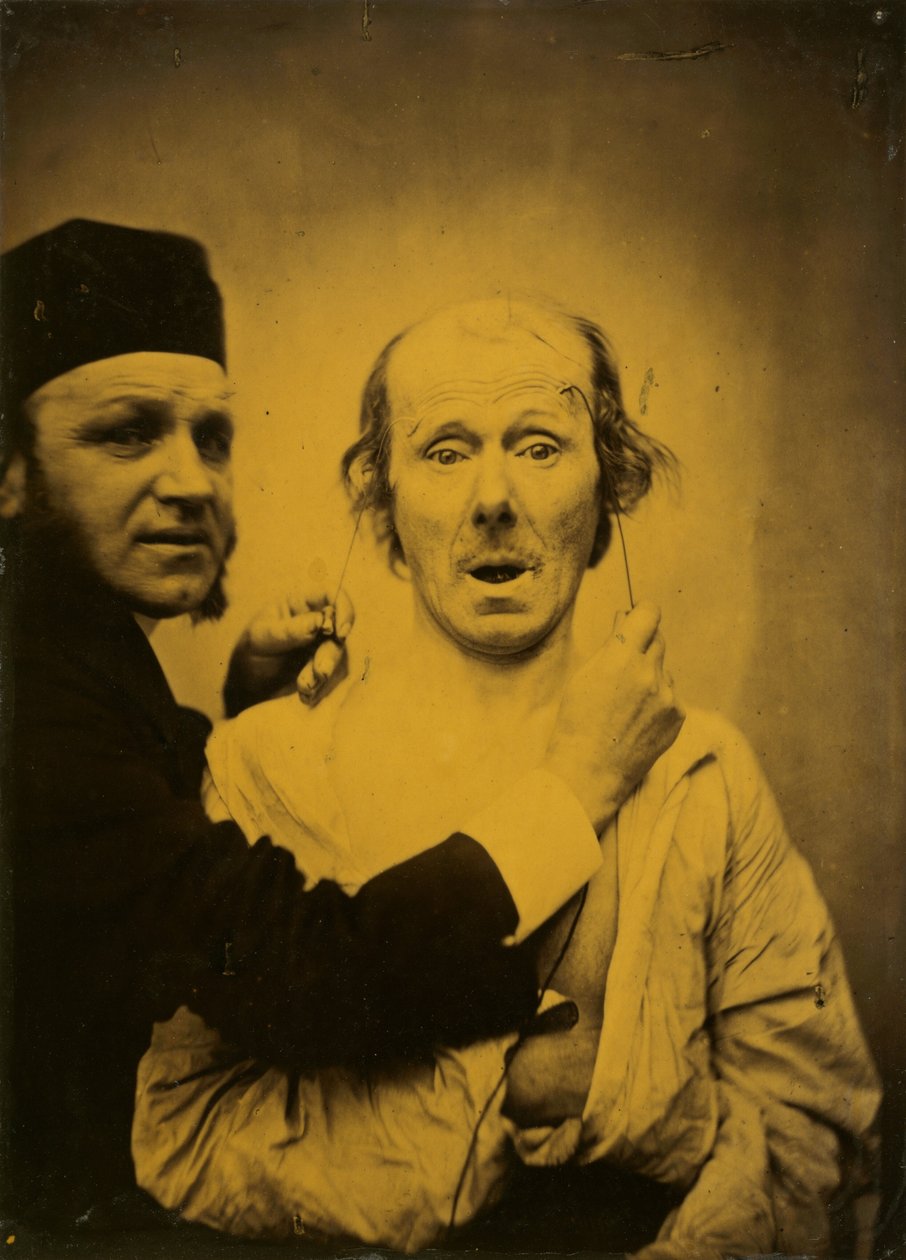 Překvapení, 1854-1855, vytištěno 1862. od Duchenne de Boulogne