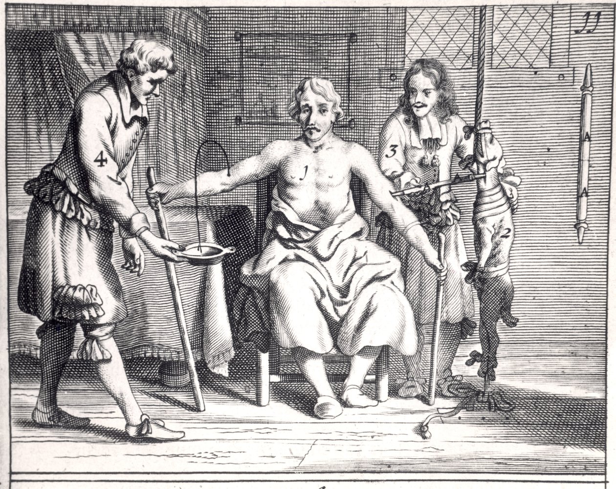 Krevní transfuze ze psa, z Armamentarii Chirurgici od Johannese Schultese (1595-1645), publikovaná v Amsterdamu, 1671 od Dutch School