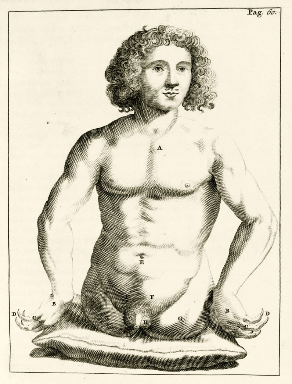 Příklad vrozených vrozených vad od Frederika Dekkerse, 1694 od Dutch School