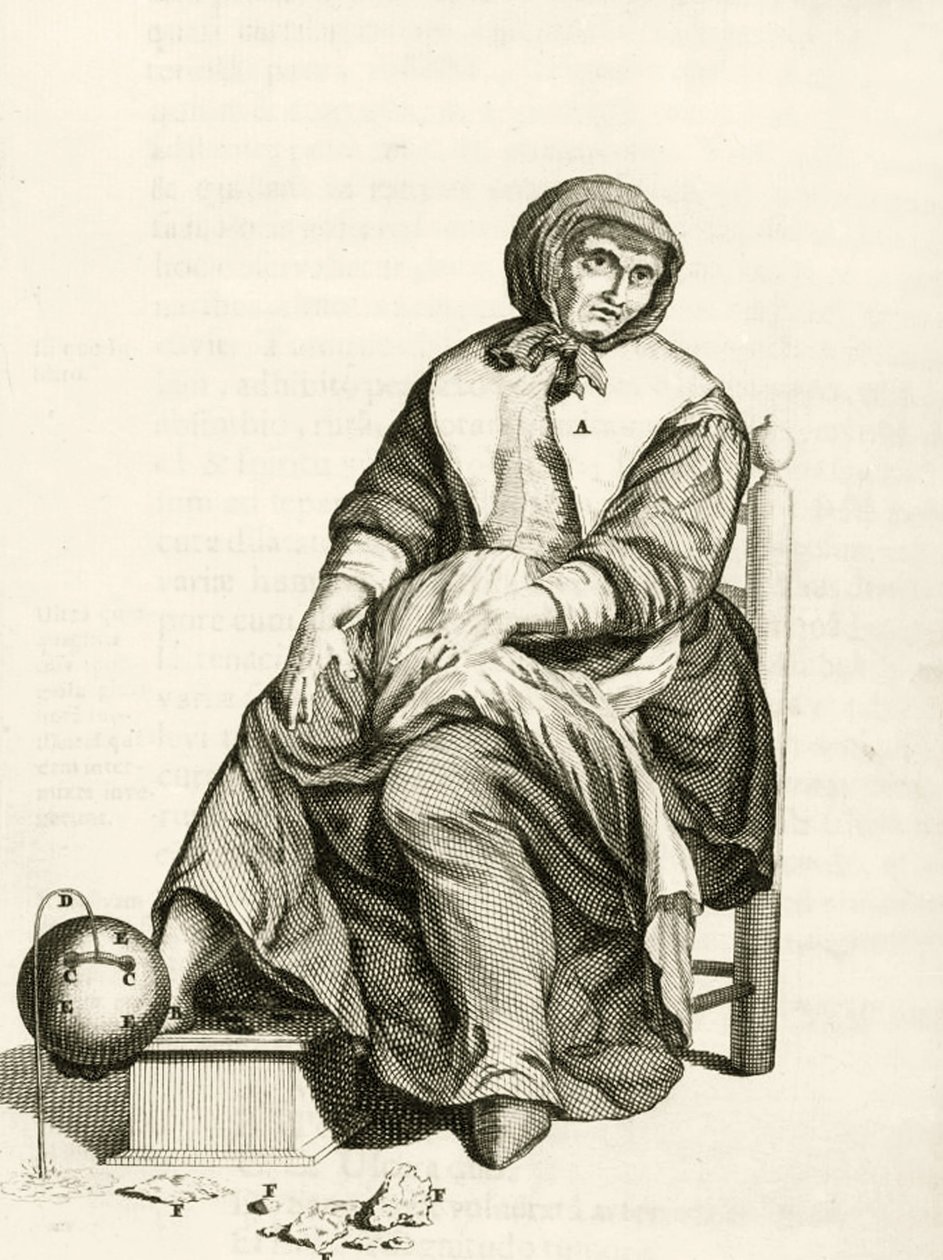 Použití mechanické pijavice, z Praktických cvičení týkajících se metody léčení od Frederika Dekkerse, 1694 od Dutch School