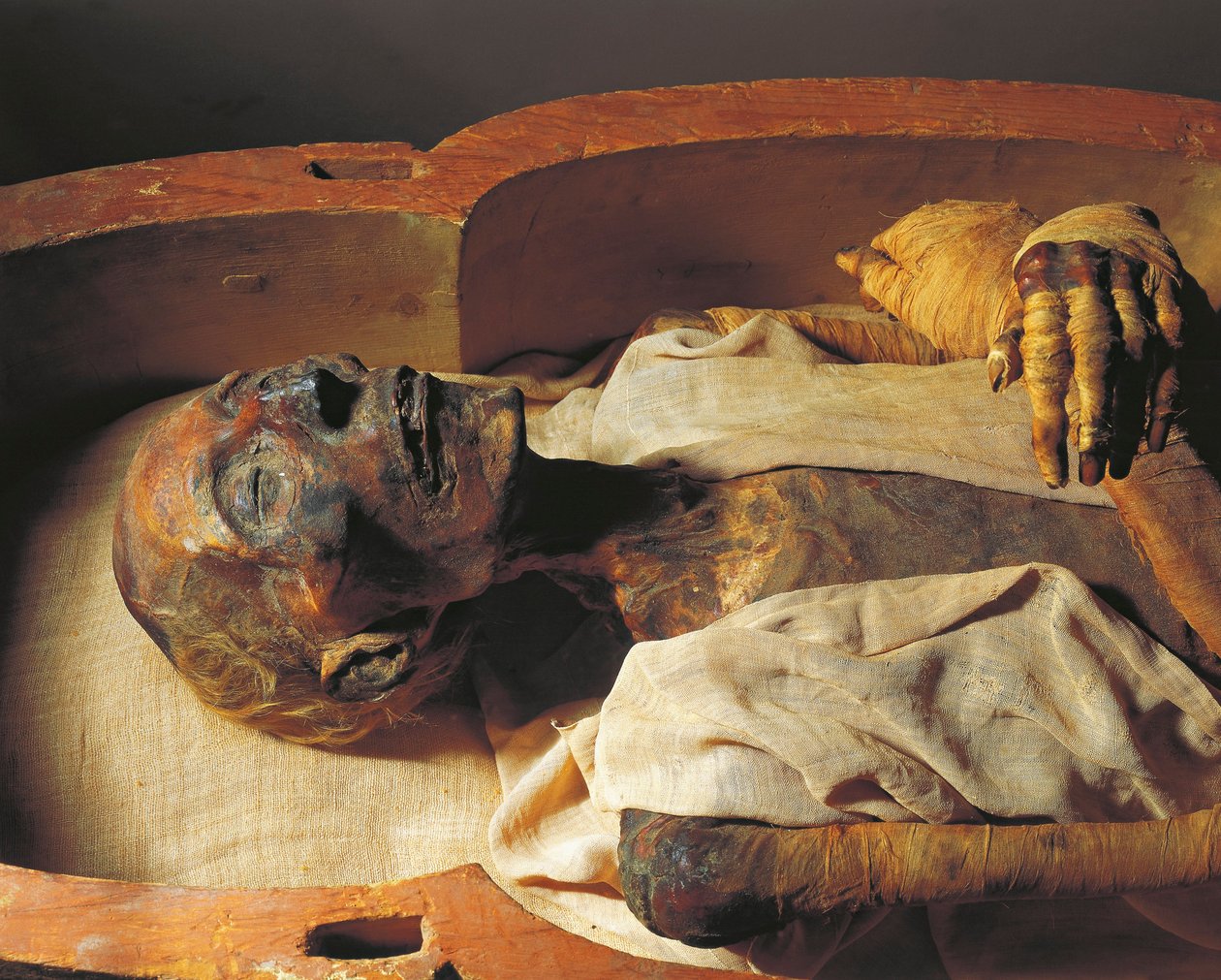Mumie Ramsese II (asi 1297-1213 př. n. l.), detail od Egyptian 19th Dynasty