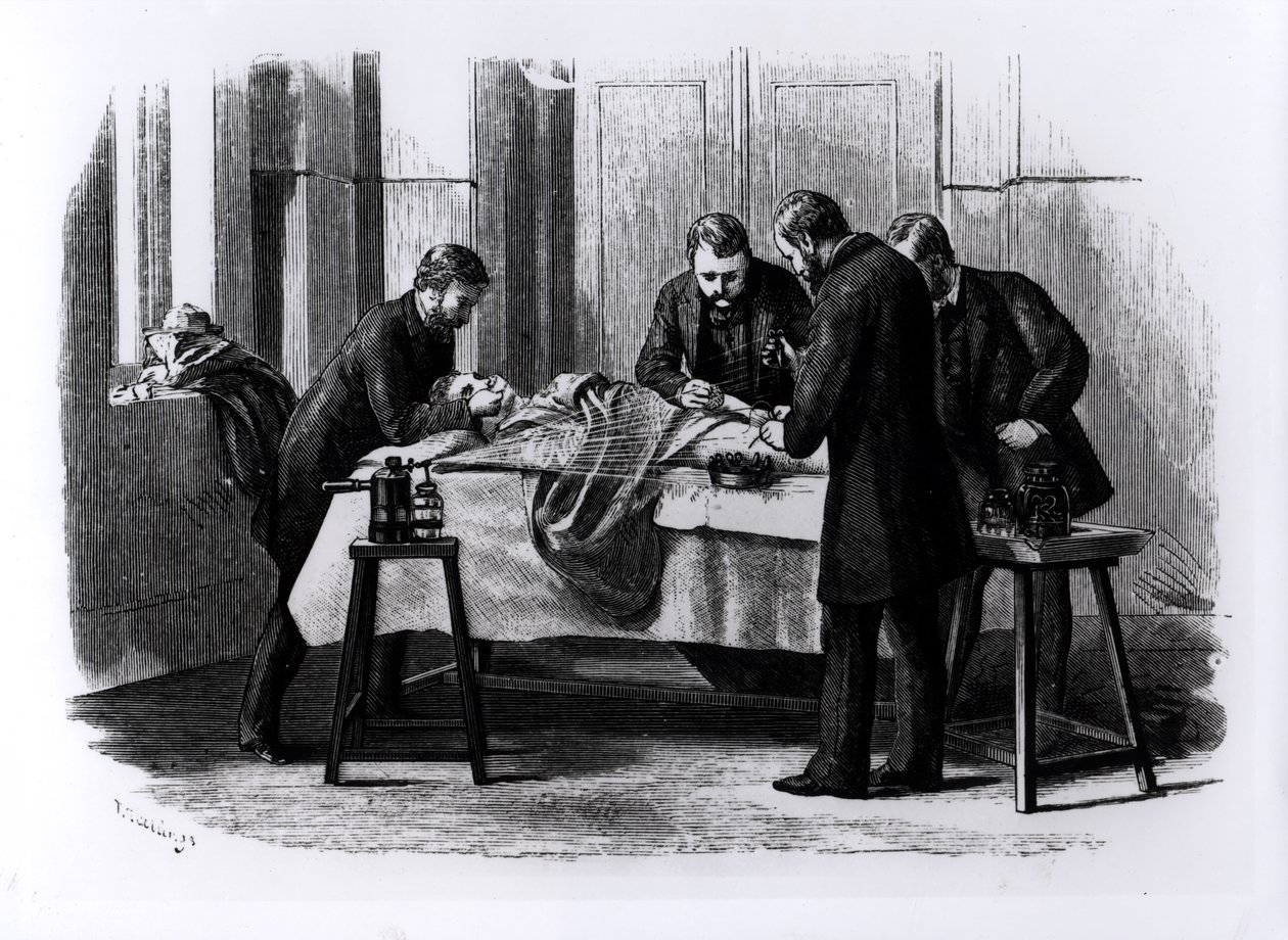 Antiseptická chirurgie, 1882 od English School