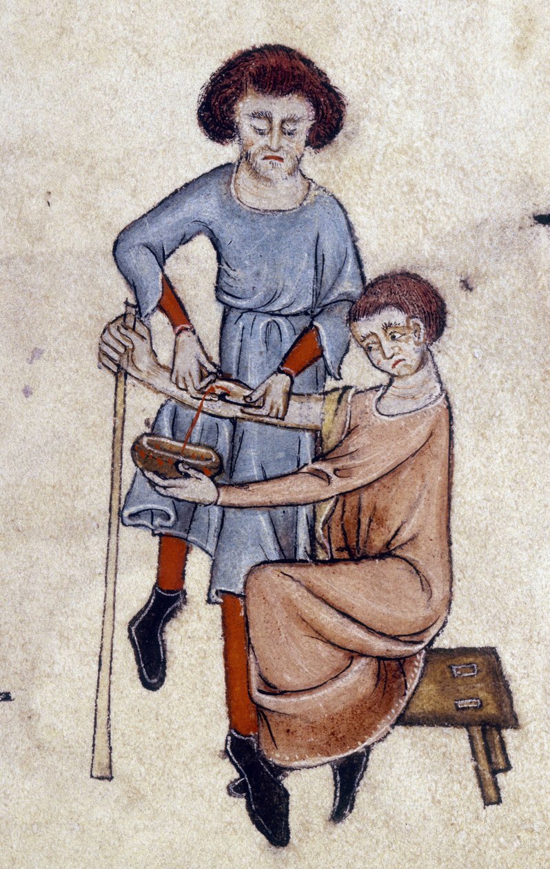 Propouštění krve, z Luttrellova žaltáře, c.1325-35 (vellum) od English School