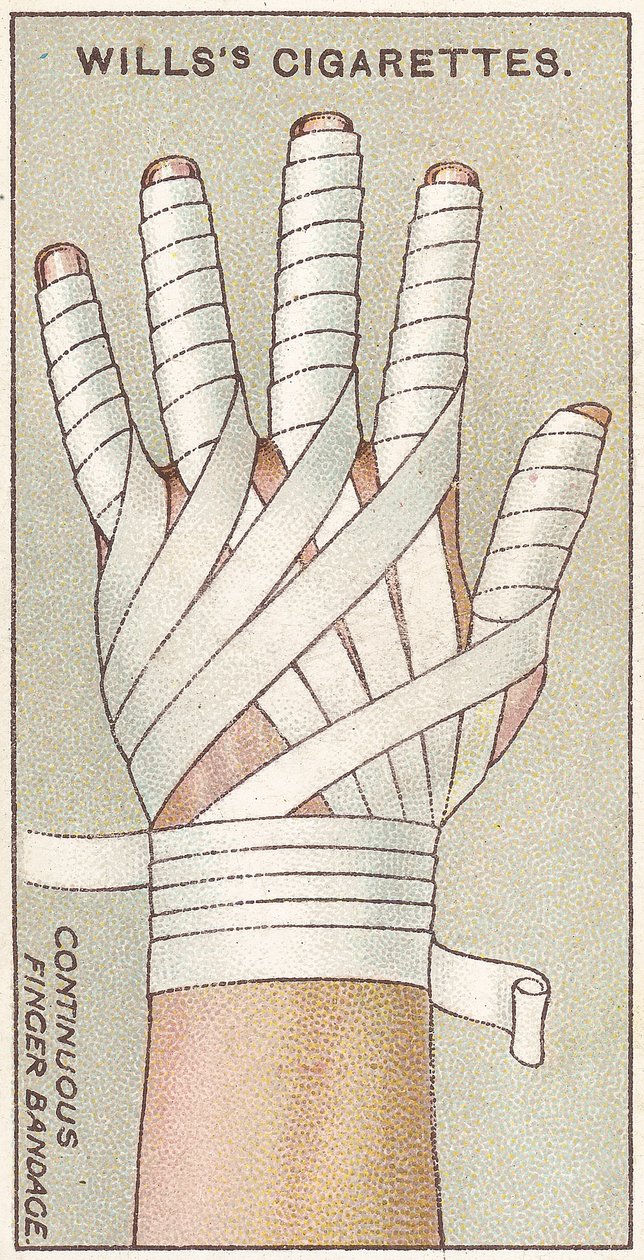 Nepřetržitá bandáž prstů, č. 48 ze série karet Willss Cigarettes First Aid, 1913 od English School