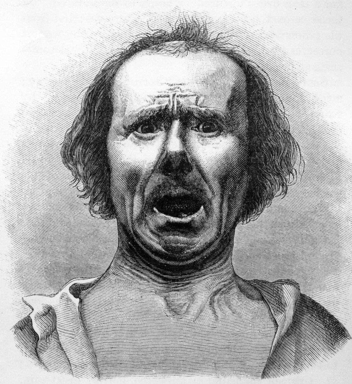 Hrůza a agónie, zkopírované z fotografie Dr. Duchenna, ilustrace z „Výraz emocí u člověka a zvířat“ od Charlese Darwina, publikované v roce 1872 od English School