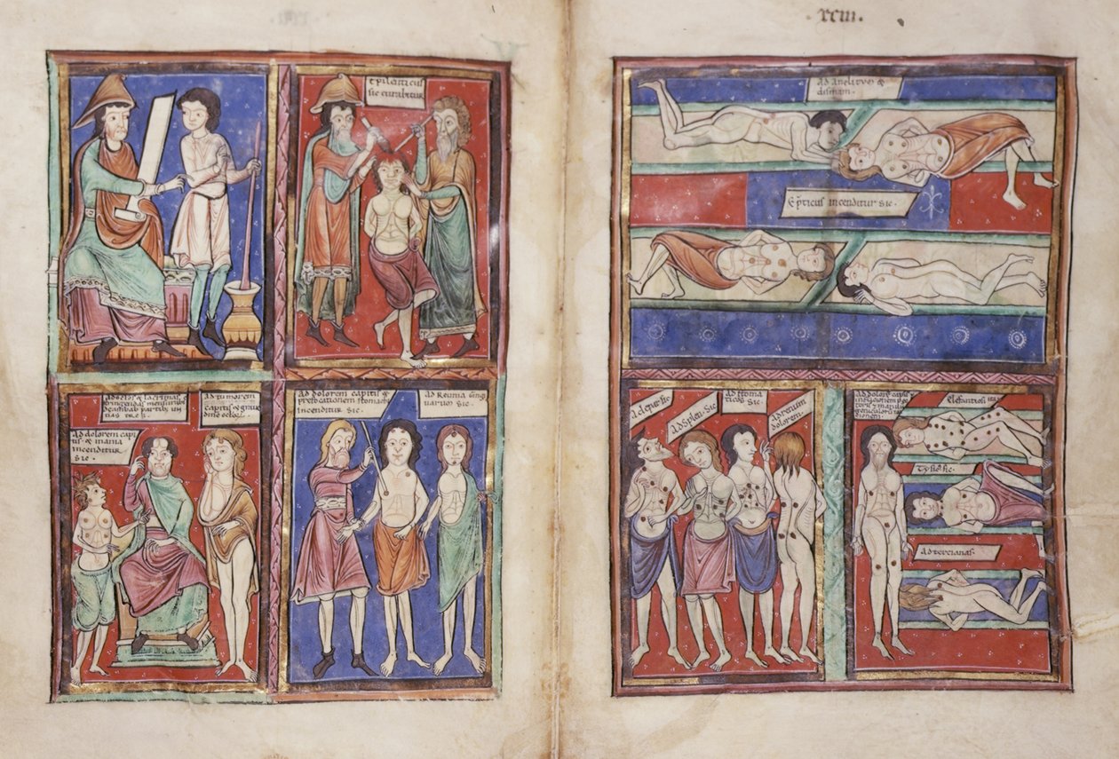 Sloane 1975 fol.91v-92 Lékařské scény od English School