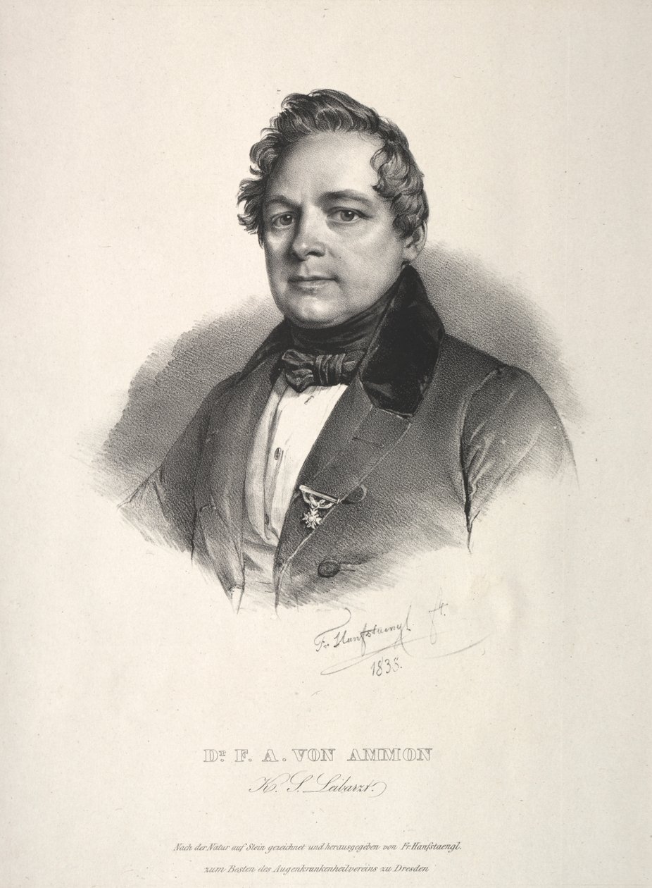 Dr Fridrich August z Ammonu od Franz Seraph Hanfstaengl