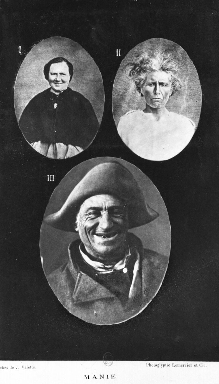 Mánie, ilustrace z Nového základního a praktického pojednání o duševních chorobách od Henriho Dagoneta (1823-1902) Paříž, Bailliere, 1876 od French Photographer