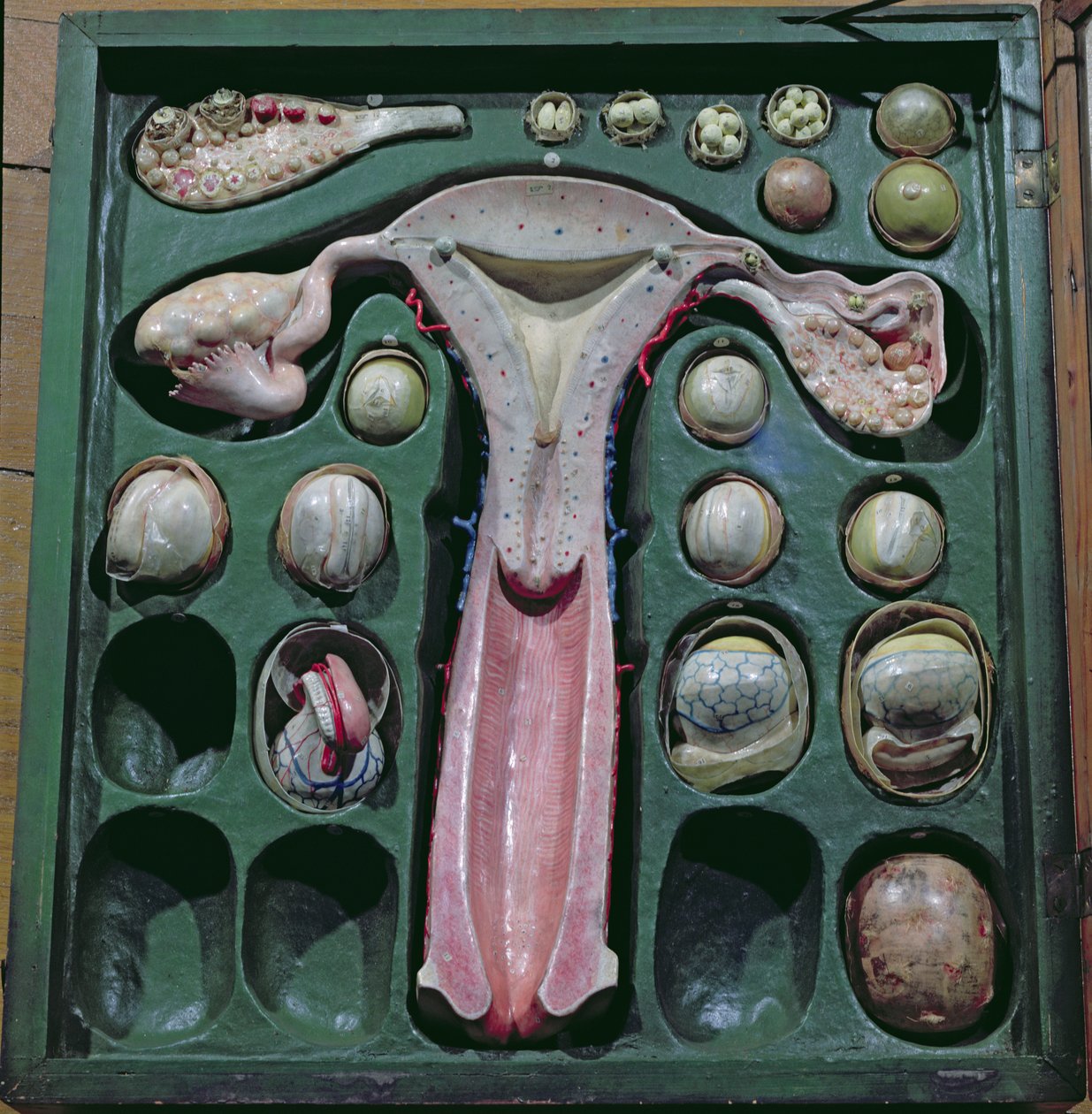 Ženské pohlavní orgány, c. 1830 (malovaný karton) od French School