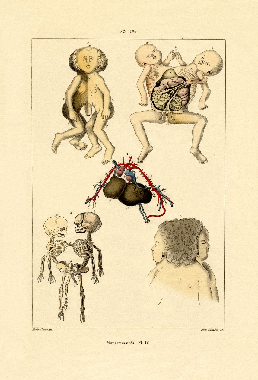 Freak, 1833-39 od French School