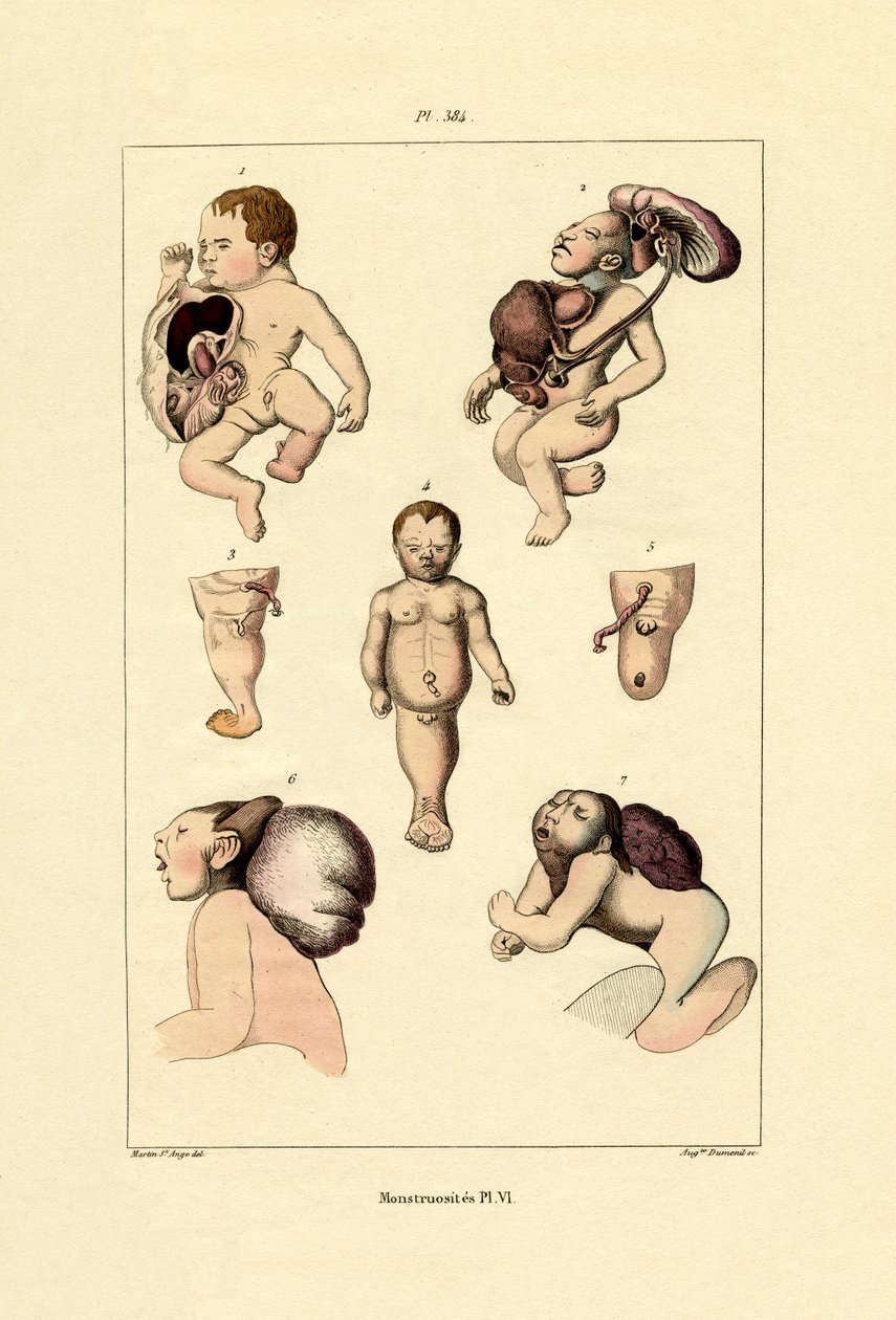Freak, 1833-39 od French School