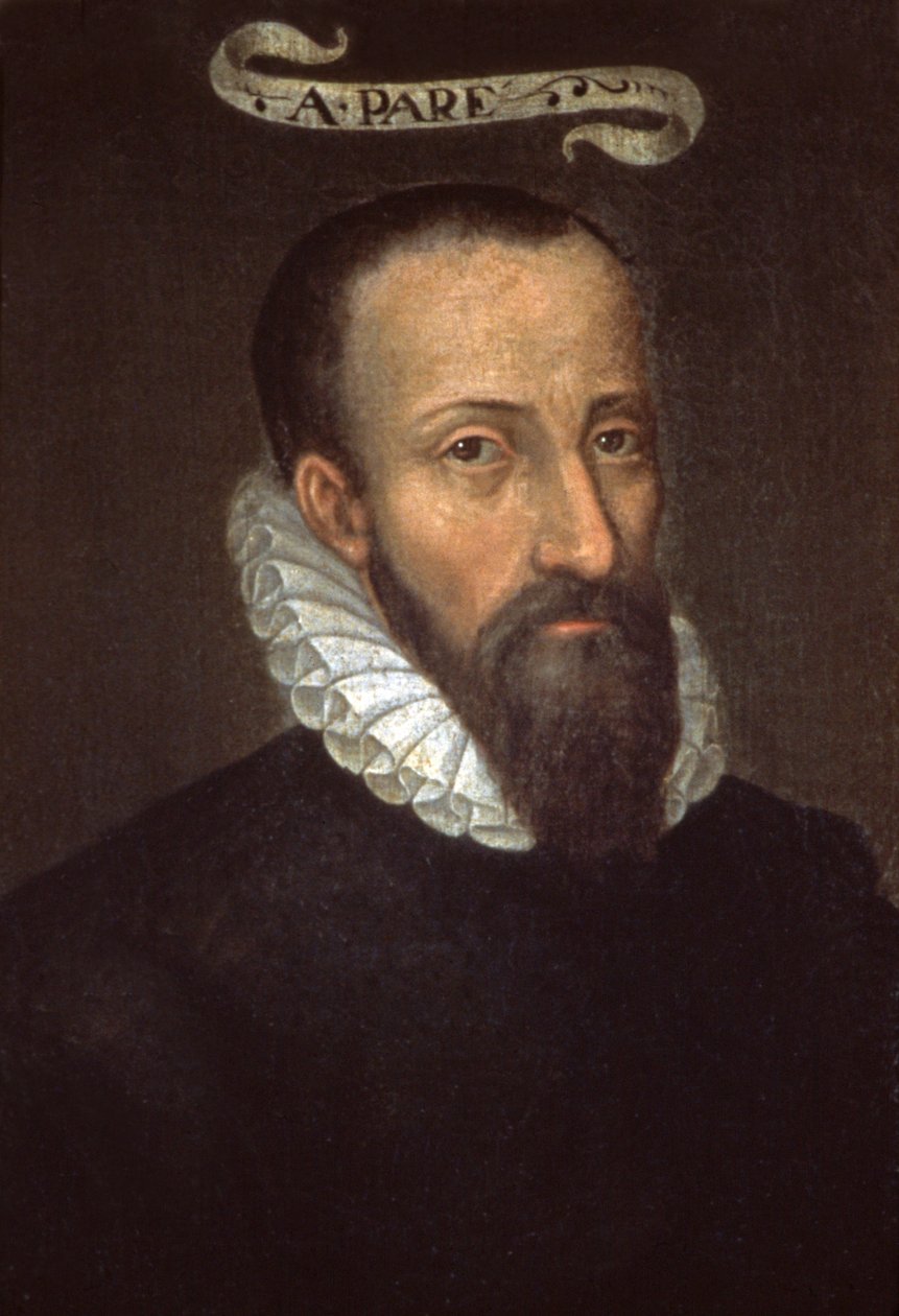Ambroise Pare. 16. století (malba) od French School