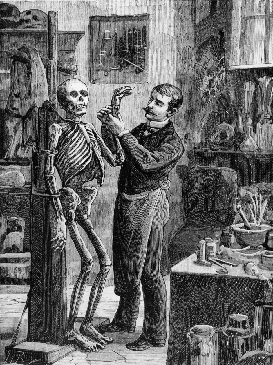 Případ Gouffé: Imaginární rekonstrukce mrtvoly Gouffé od Dr. Lacassagne - v „La Malle Sanglante“, ed. A. Fayard, Paříž, n. d. - Paříž, B.H.V.P.D. od French School