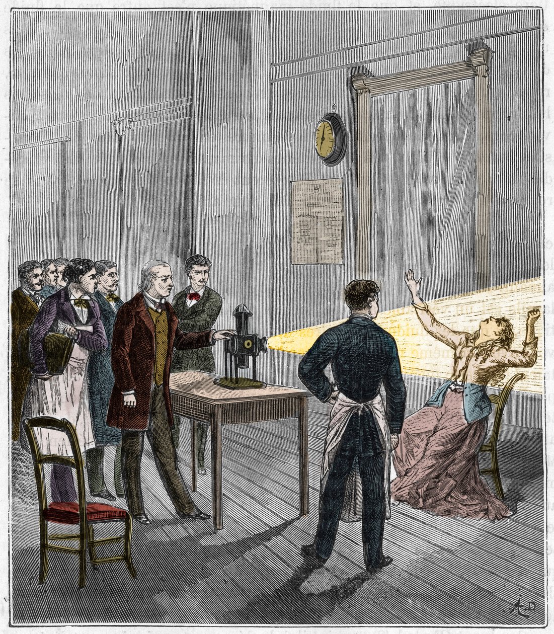 Katalepsie vzniklá pod vlivem světla - Francouzský neurolog Jean Martin Charcot (1825-1893) studující fenomén hypnózy na pacientovi v nemocnici Salpetriere pomocí kouzelné lucerny - Katalepsie - Jean Martin Charcot (1825-1893), francouzský neu od French School