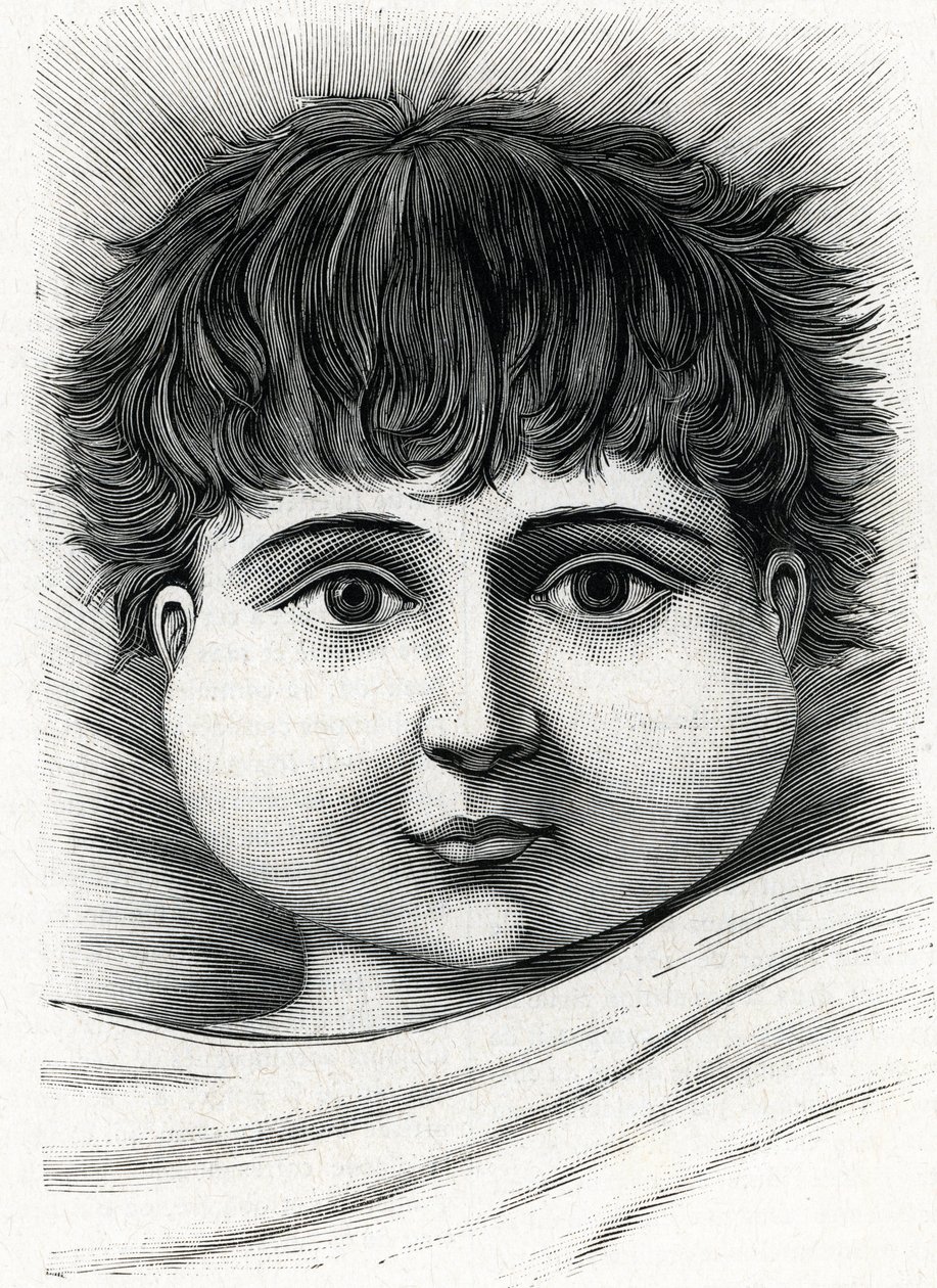 Dítě s nemocí příušnic (rytina) 1888 od French School