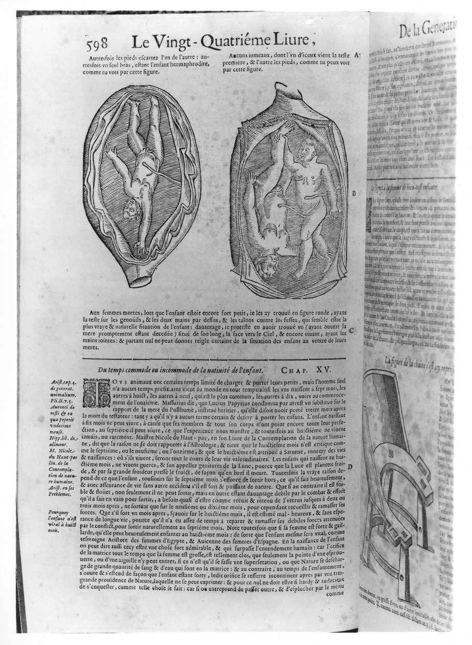 Foetus, ilustrace z Oeuvres od Ambroise Pare (1509-90) publikovaná v Lyonu, 1641 od French School
