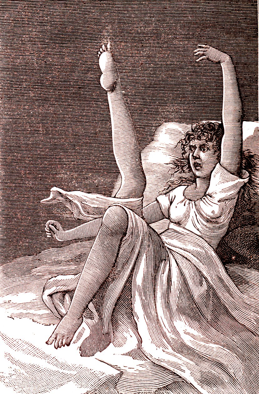 Hysterie, extrémně duševní jev, psychózy a psychoneuróza. 1887 (rytina) od French School