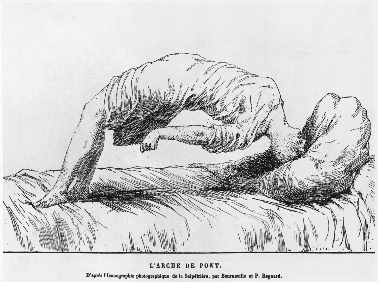 Hysterie a somnambulismus, z Les Maladies Epidemiques de lEsprit od Paula Regnarda (1850-1927) 1884 od French School