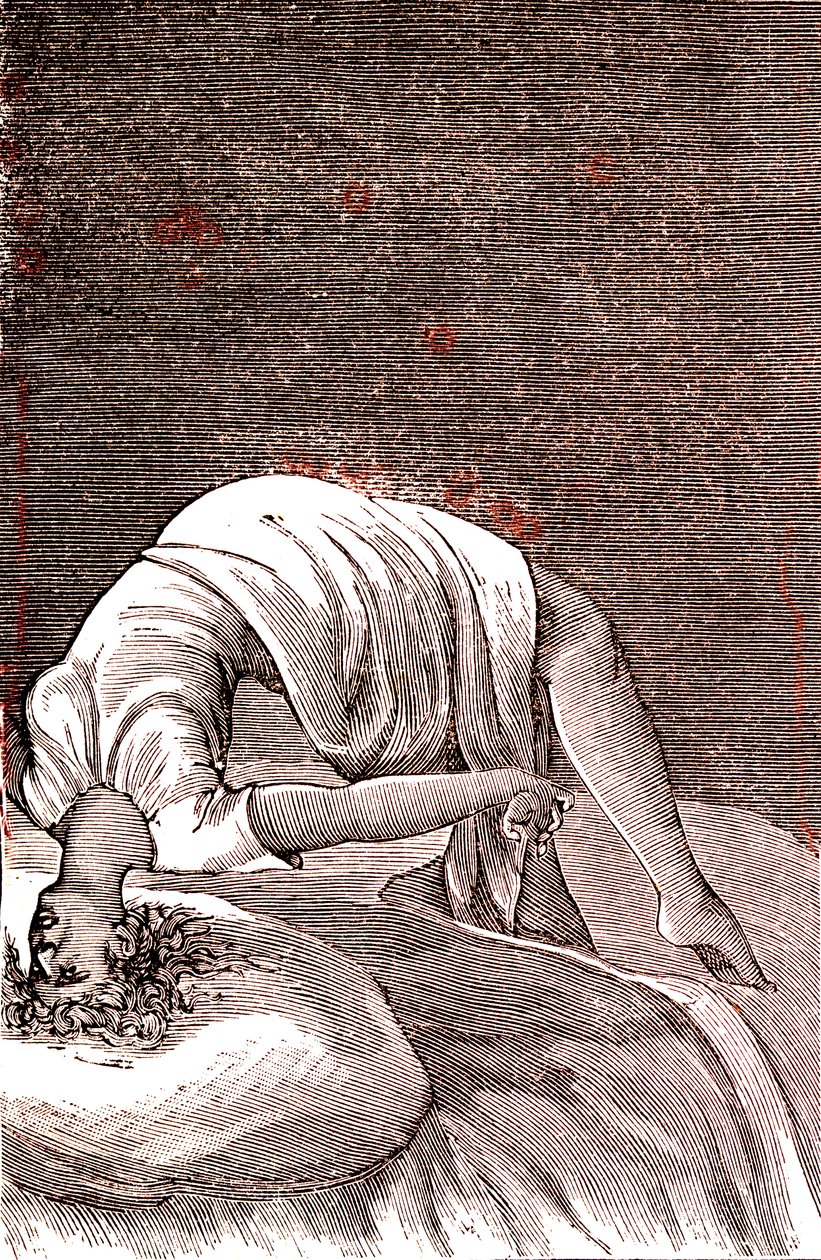 Hysteria, henkinen ja hermoston häiriö, joka johtuu voimakkaasta ahdistuksesta. 1887 (kaiverrus) od French School
