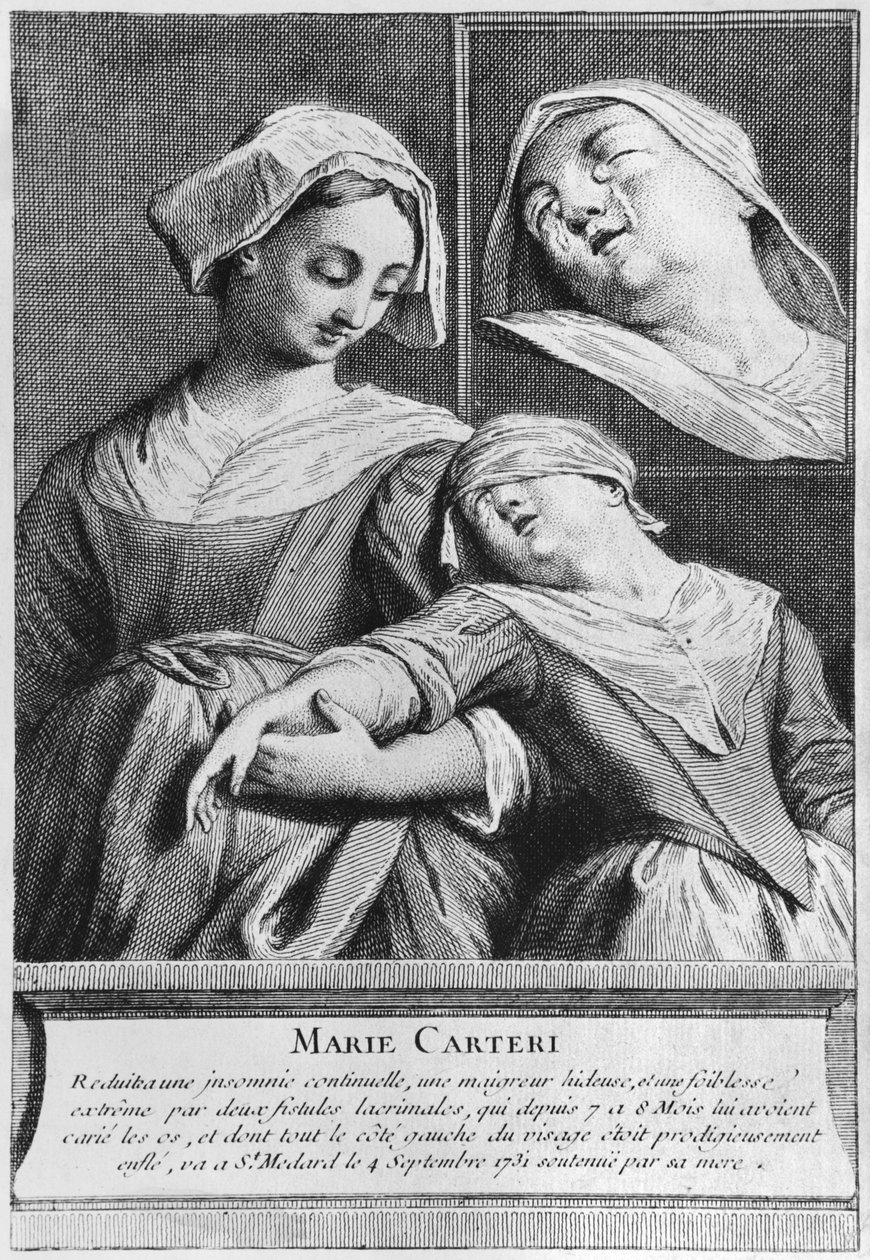 Zázračné uzdravení slepé ženy Marie Carteri na hrobě jáhna Francoise de Paris na farním hřbitově Saint-Medard v Paříži. od French School