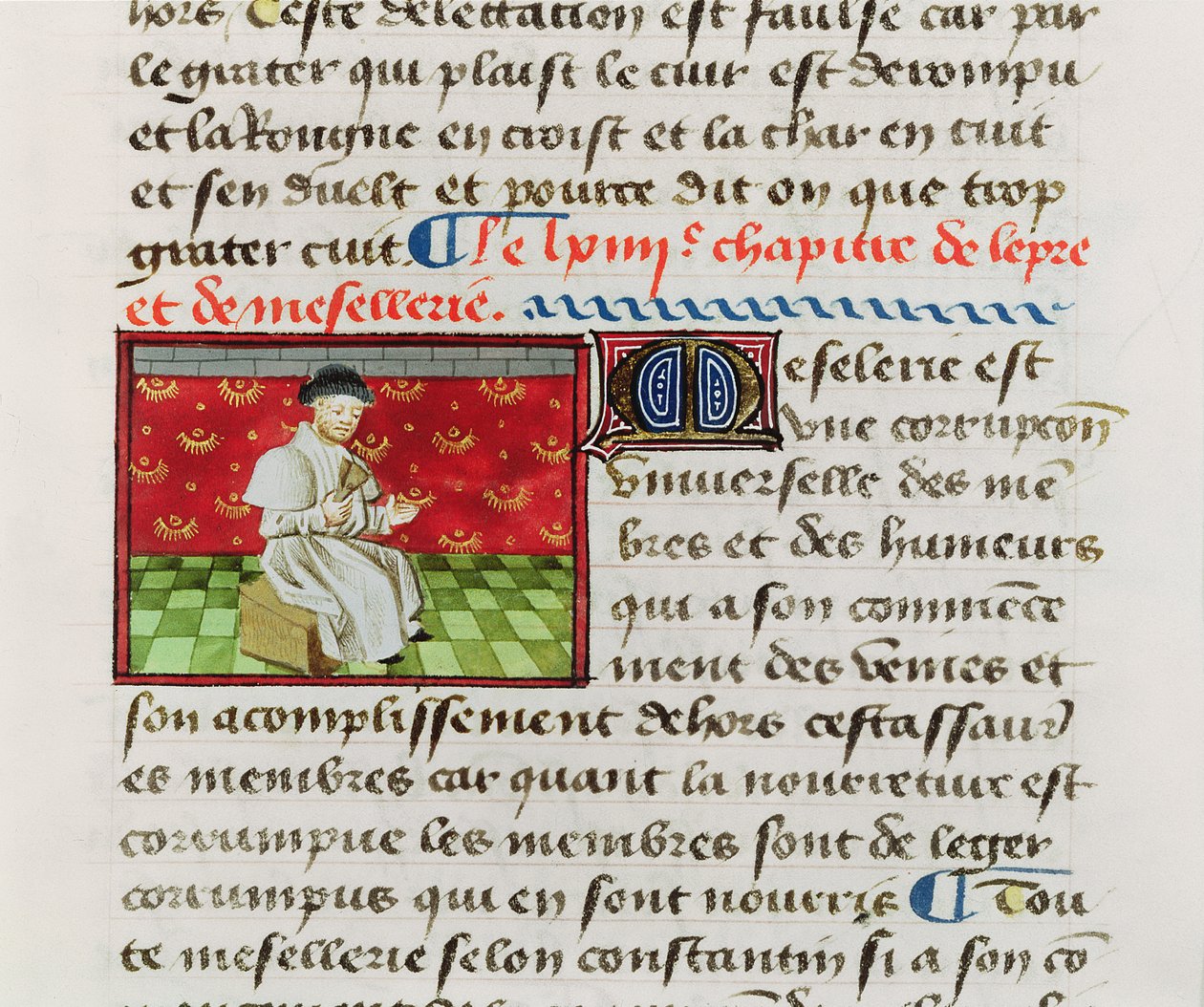 Paní Fr. 22532 Fol.118 Leper, z Le Livre des Proprietez des Choses od Barthelemyho lAnglaise od French School